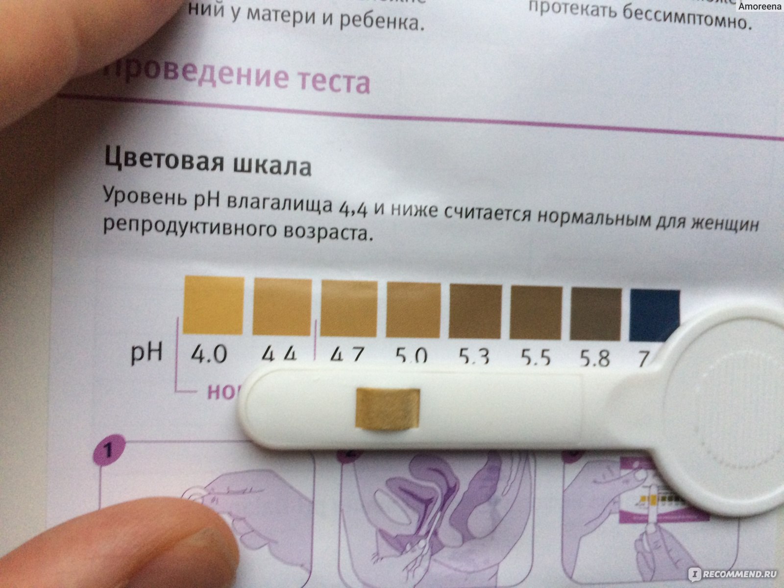 Определение pH вагинальной среды - измерение ph влагалища в Одессе