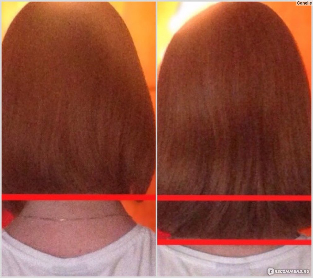 рост волос на голове у женщин за месяц
