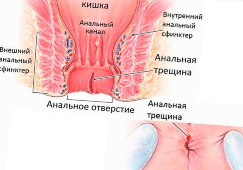 Колопроктология в Ильинской больнице
