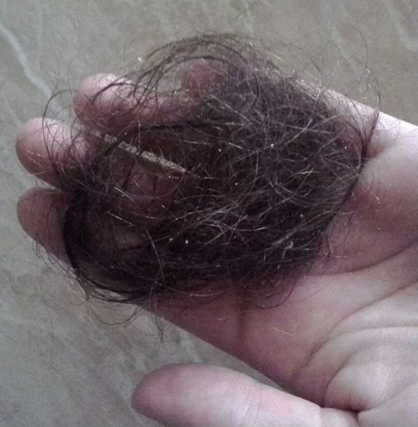 Фото выпавших волос. Сотное выпадение волос.