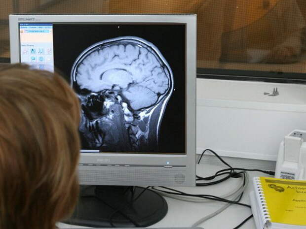 Рентген головного мозга  фото