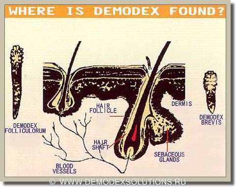 Соскобы кожи и ресницы на клещи (демодекс) фото