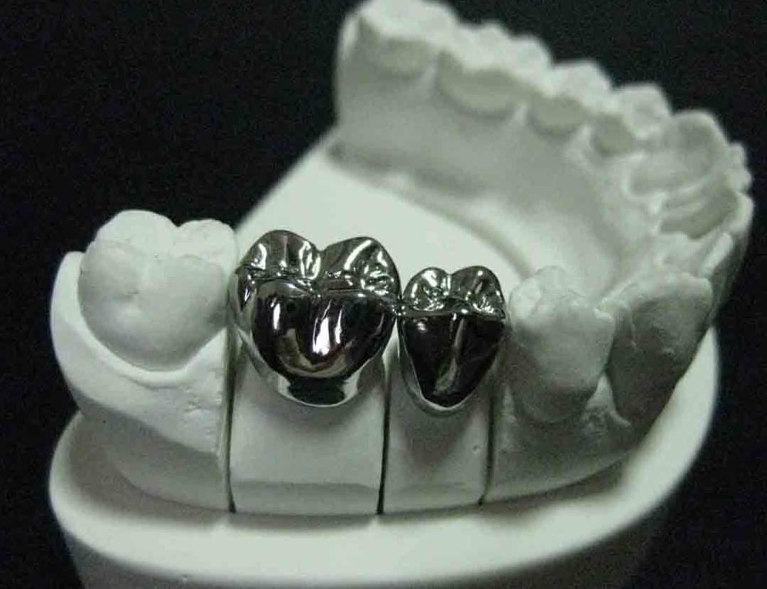 Протезирование зубов. Цельнометаллические коронки фото